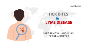 Tick Bites and Lyme Disease- Safe Removal and When to See a Doctor